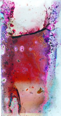 Vitreous Body